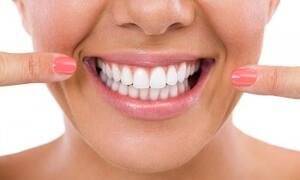 Нужно ли чистить зубы от налета?